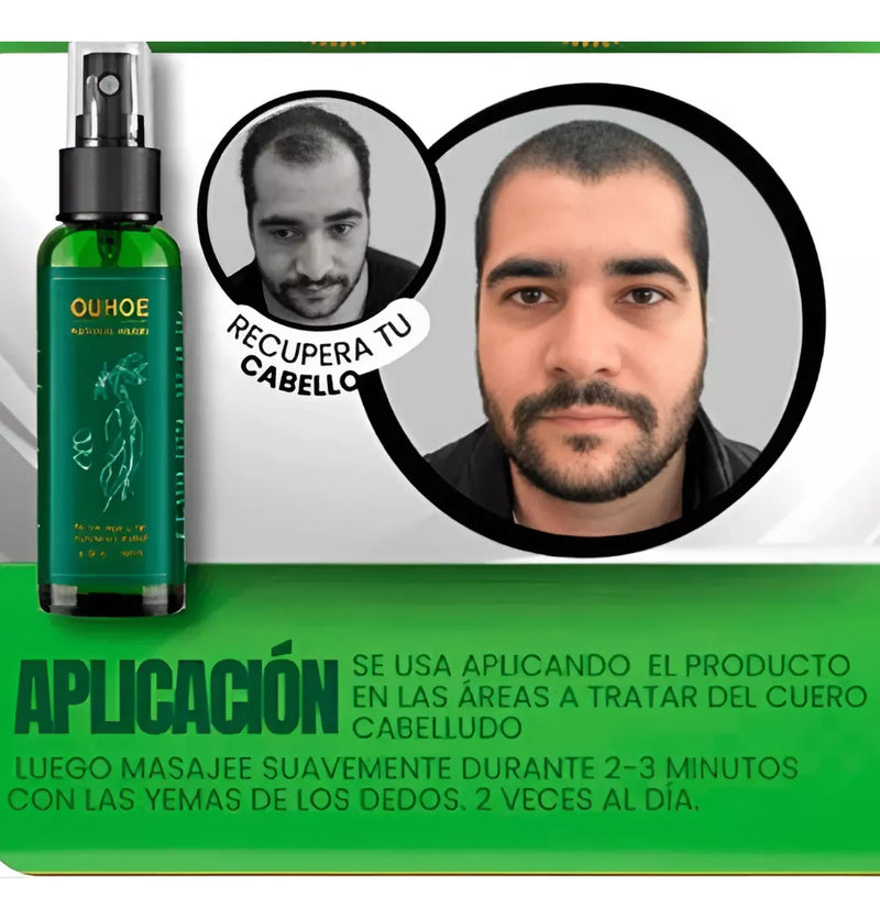 OUHOE - REPARADOR DE CRECIMIENTO CAPILAR 100% EFECTIVO - KIT CON 2